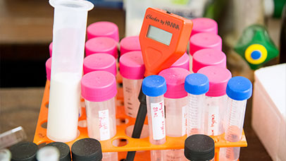 a collection of specimen tubes