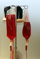 bags of blood beside a hospital bed