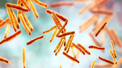 abstract image of tuberculosis cells