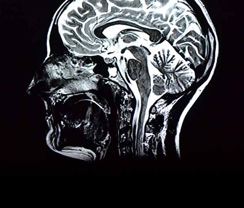 abstract view of a brain scan