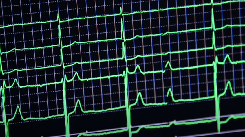 Close up of a heart monitor