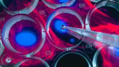 Pipette in petri dishes.