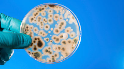 Colonies on petri dish