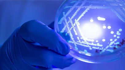 A petri dish