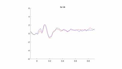 EEG recording graph