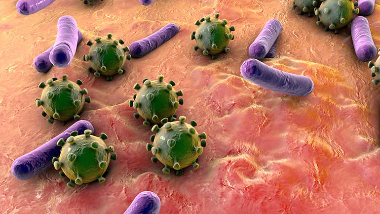 Viruses and bacteria