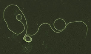 Livewort sperm