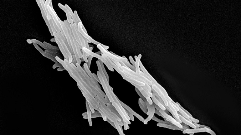 Mycobacterium tuberculosisis