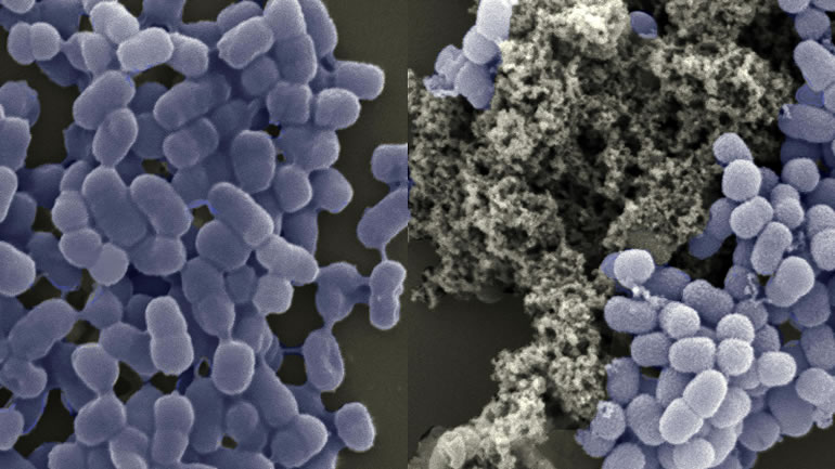 Bacteria