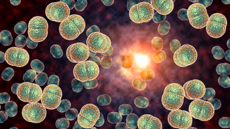 Illustration of bacterial meningitis
