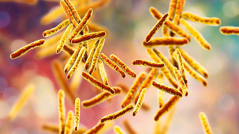 Tuberculosis illustration