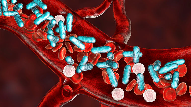 Illustration of sepsis in bloodstream