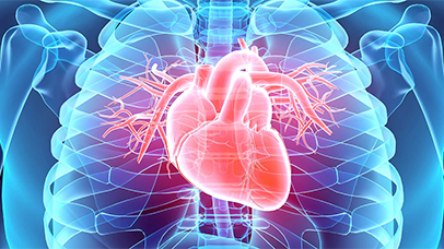 X Ray image of a human heart