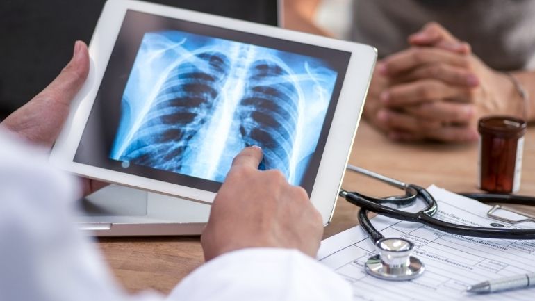 A clinician inspects a scan of lungs on a tablet computer, with patient in the background.