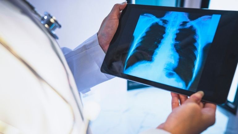 A doctor examines an X-ray of a patient's chest.