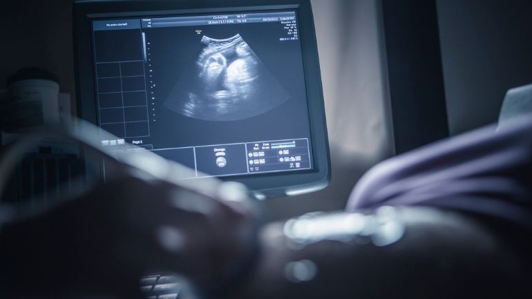 A woman receives an ultrasound scan.