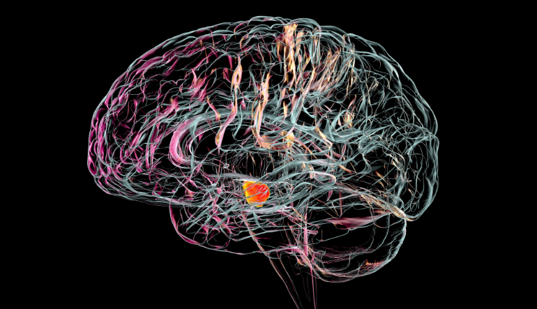 Parkinsons brain