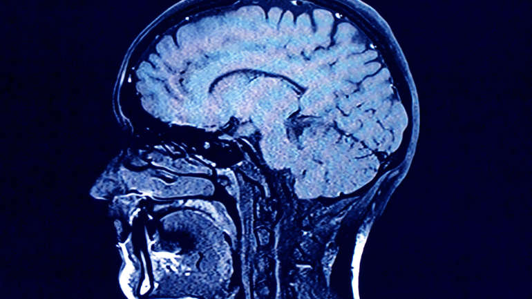 Brain 770