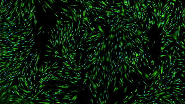 Fluorescent microscope images of cultured vascular smooth muscle cells showing the main cell body (cytoplasm) in green and the nucleus (blue) that contains the cells’ DNA.