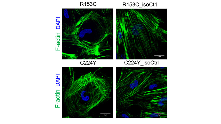 Immunofluorescence (IF) staining of F-actin in Induced Pluripotent Stem Cell-derived Vascular Smooth Muscle Cells (iVSMCs) derived from CADASIL and Isogenic control induced pluripotent stem cells (isoCtrl iPSCs). Nuclei were counterstained by DAPI (4′,6-diamidino-2-phenylindole).