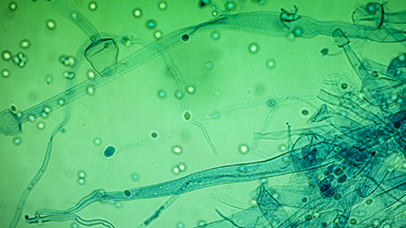 An image showing effects of pollution