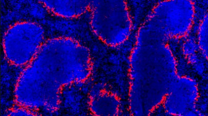 Close up of infection models under microscope