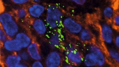 Close up of host microbial under microscope