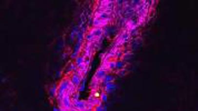 Close up of pneumonia strain