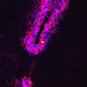 a cluster of pneumococcal cells replicating