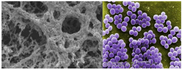 Left: a biofilm of Streptococcus pneumoniae following treatment with black carbon, a major component of air pollution. Right: amicroscopy image of single S. pneumoniae cells.