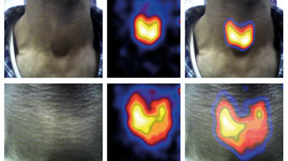 Medical imaging of the thyroid gland.