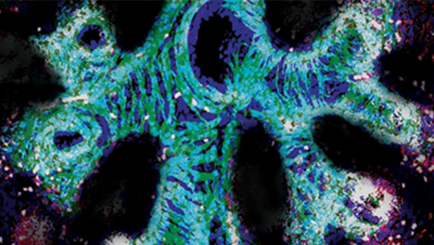 Image shows colourscan close up of a foetal lung, displaying in green, purple and turquoise colours.