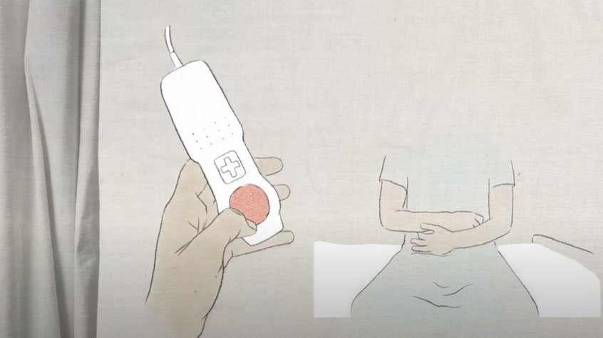 Animation of a person clutching their stomach, whilst sitting on a gurney.