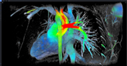 cardiovascular imaging