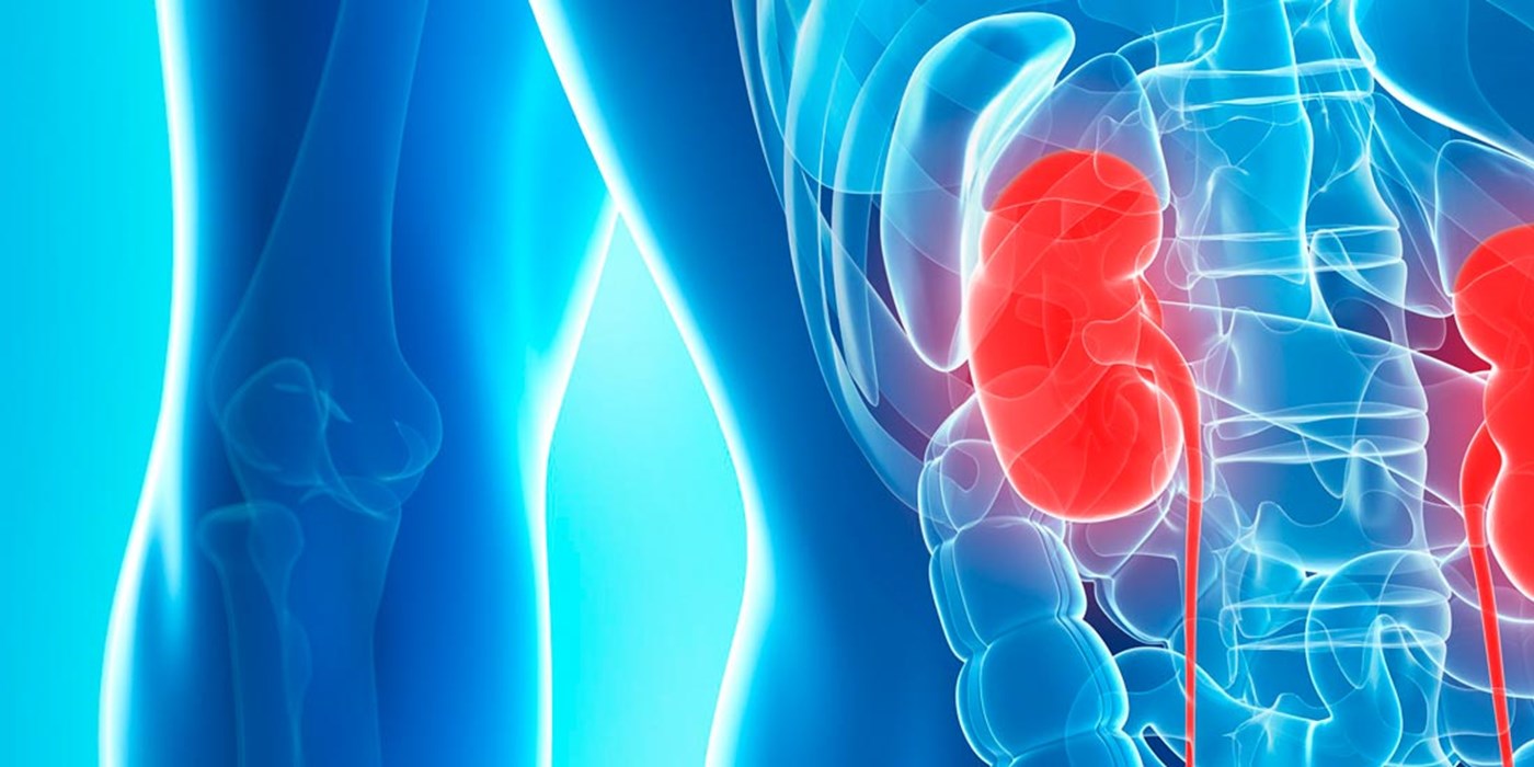 Illustration of a body with kidneys highlighted in red