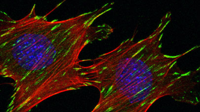 Multiphoton fluorescence image of HeLa cells stained with the actin binding toxin phalloidin