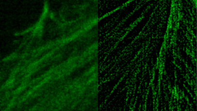 SRRF imaging
