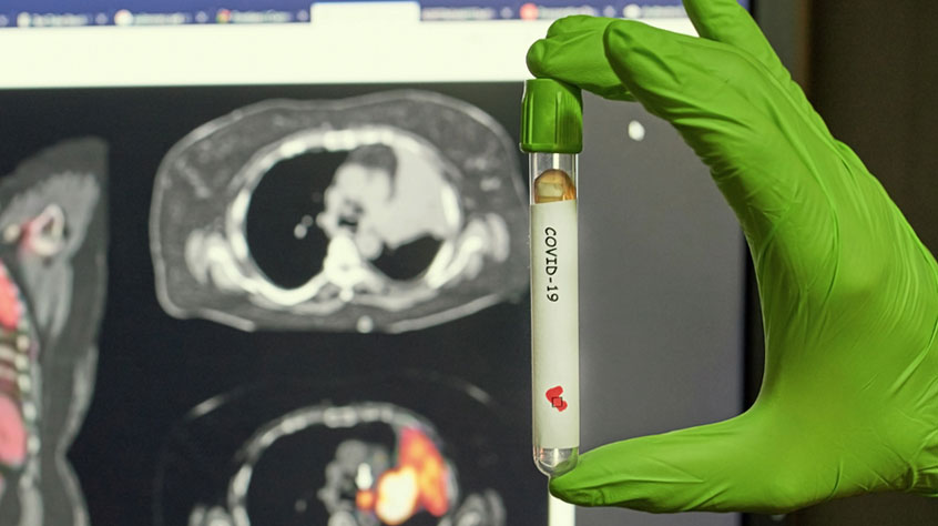 Hand holding a tube labelled covid-19