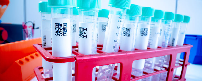 We are proud to be in the top ten UK universities for COVID-19 research, having secured more than £10 million of funding. With the UK’s largest respiratory health department and world-leading research on ethnic health, we are leading one of the world’s largest studies into the long-term health impacts of COVID-19.  