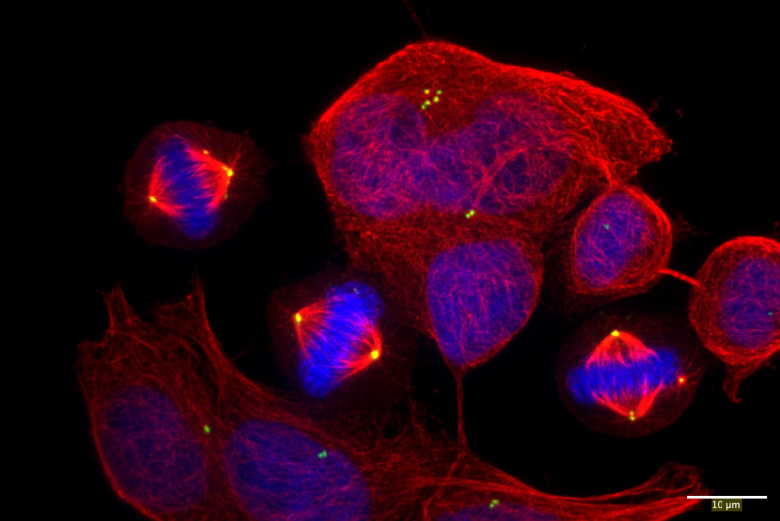 Cancer cells promote cell division errors