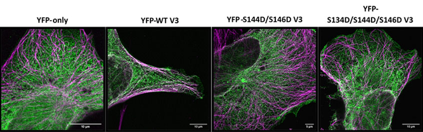 Image showing the identification of point mutations within EML4-ALK V3 that cause dissociation of the oncoprotein from microtubules. 