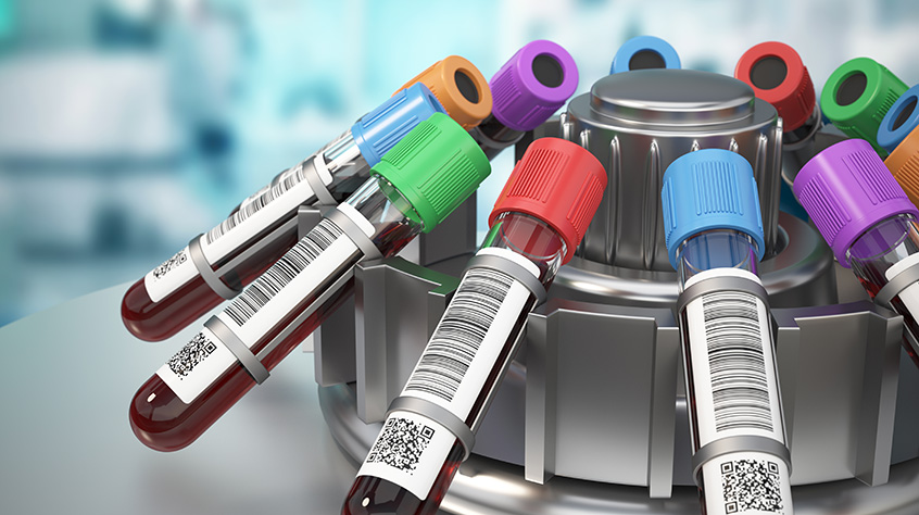 Several different coloured labelled test tubes locked in a device