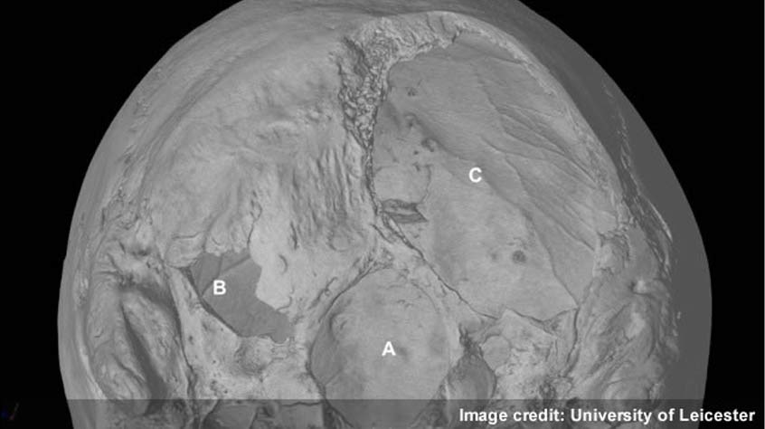 This micro-CT image shows two potentially fatal injuries near to the point where the skull meets the spine (A). B is probably a cut from a sword, while C is a massive slice taken out by something like a halberd. The interior of the skull is visible through all three holes; this becomes clearer when the 3D image is rotated.