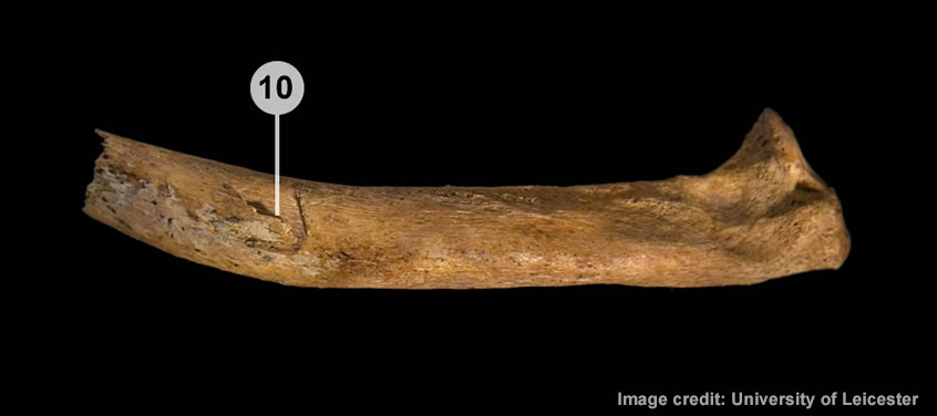 A cut on Richard III's right tenth rib