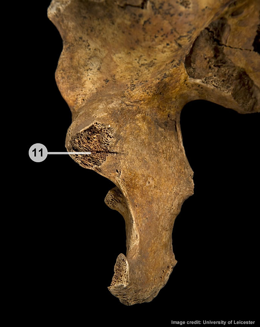 Cut on inside of Richard III's pelvis