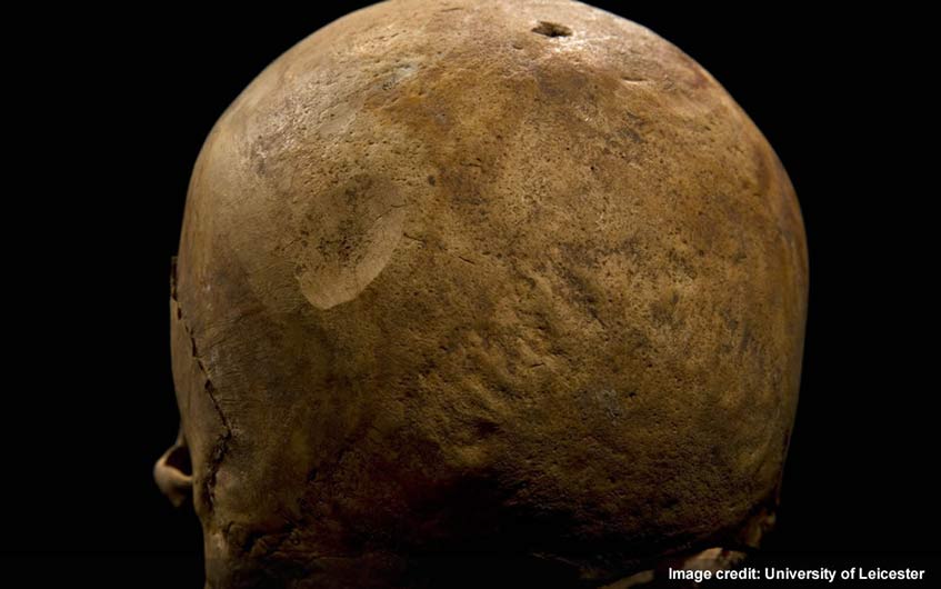 Wounds to left rear of skull and top of skull