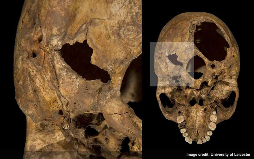 Wound on left base of Richard III's skull