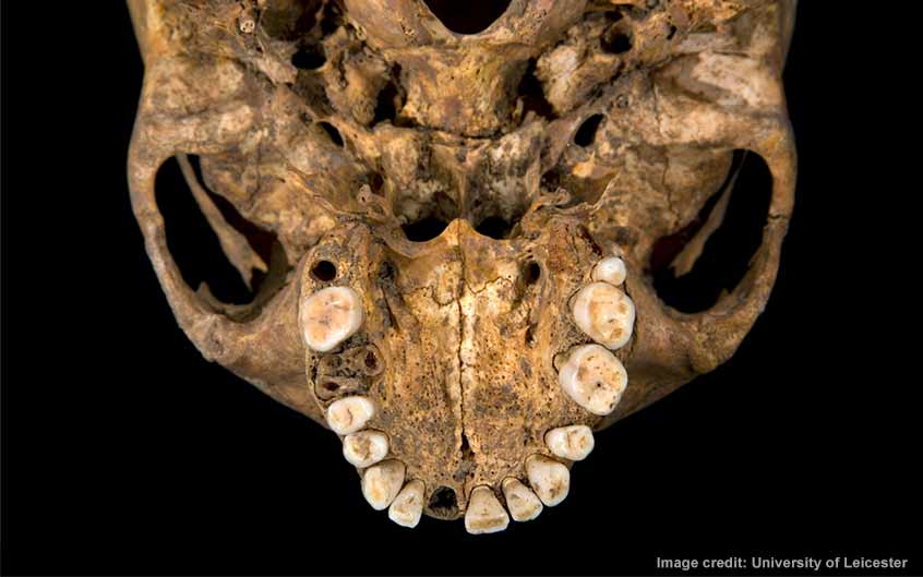 The upper jaw of the skeleton. Some teeth were lost before death, whilst others were lost in the ground. The third molars are unusually small.