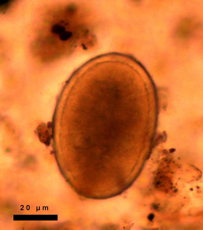 Decorticated roundworm egg (Ascaris lumbricoides) from sacral sample of Richard III. Dimensions 64.1 x 45.6 µm