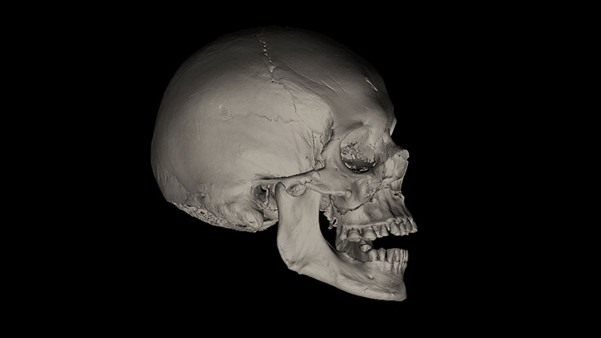 Micro-CT Scan of Richard III’s Skull